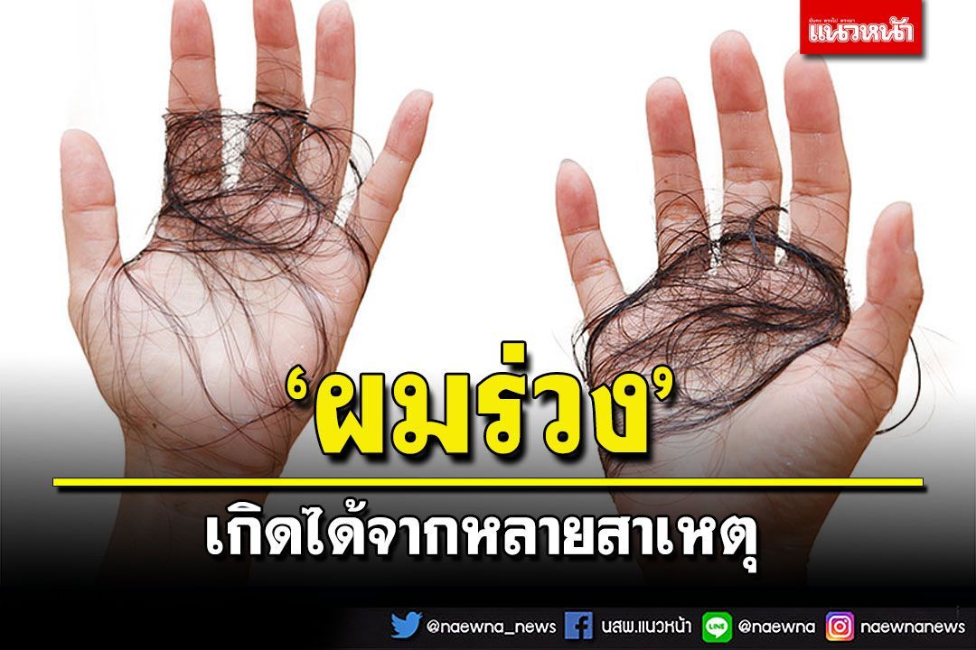 แพทย์ผู้เชี่ยวชาญชี้‘ผมร่วง’เกิดได้จากหลายสาเหตุ