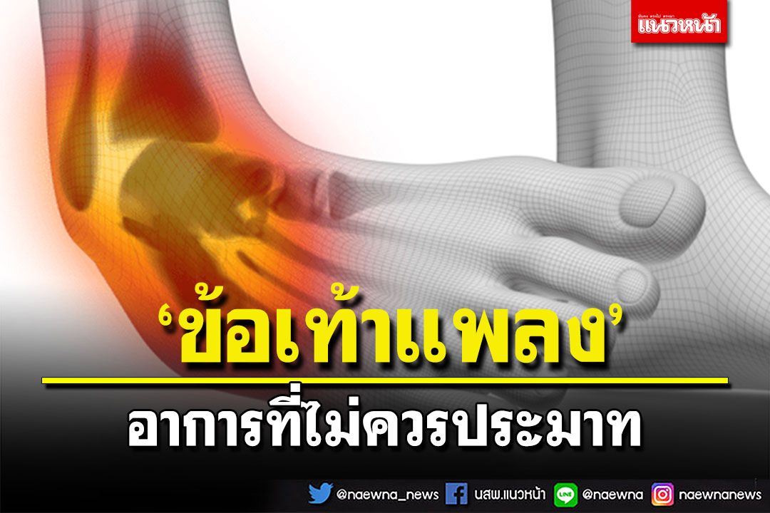 ‘ข้อเท้าแพลง’อาการที่ไม่ควรประมาท!