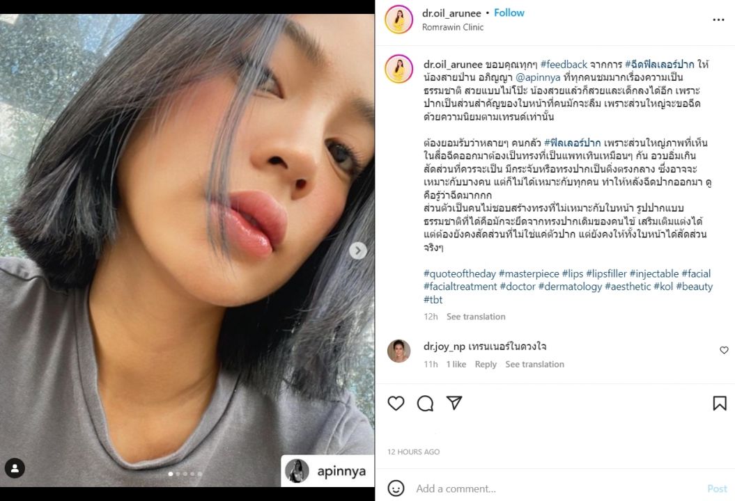 ชาวเน็ตสงสัย'สายป่าน อภิญญา'ไปทำอะไรมาหน้าเด็กลง