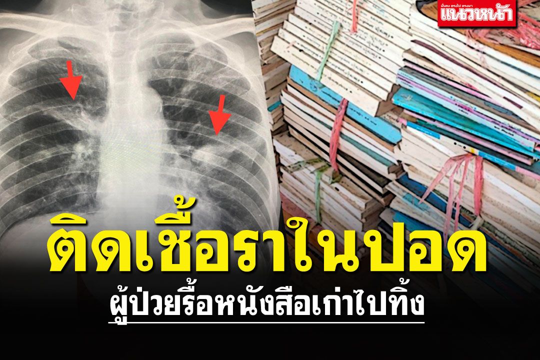 ภัยที่คาดไม่ถึง! 'หมอมนูญ'พบคนไข้ ป่วยเชื้อราในปอด จากการรื้อหนังสือเก่าๆ