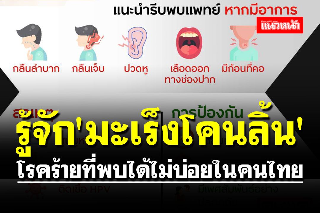 รู้จัก 'มะเร็งโคนลิ้น' โรคร้ายที่พบได้ไม่บ่อยในคนไทย