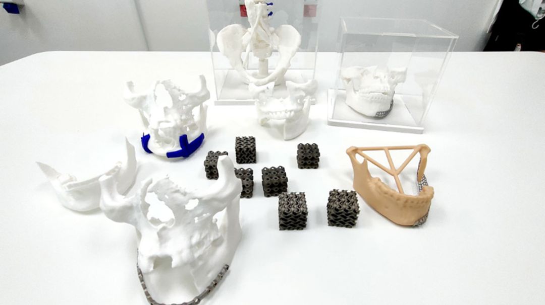 มจธ. ต่อยอดเชิงพาณิชย์ งานวิจัย 3D print  ทางการแพทย์ ‘วัสดุทดแทนกระดูก’