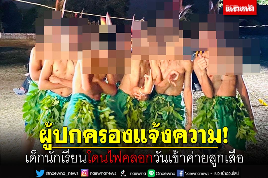 ผู้ปกครองแจ้งความ! เด็กนักเรียนโดนไฟคลอก วันเข้าค่ายลูกเสือ