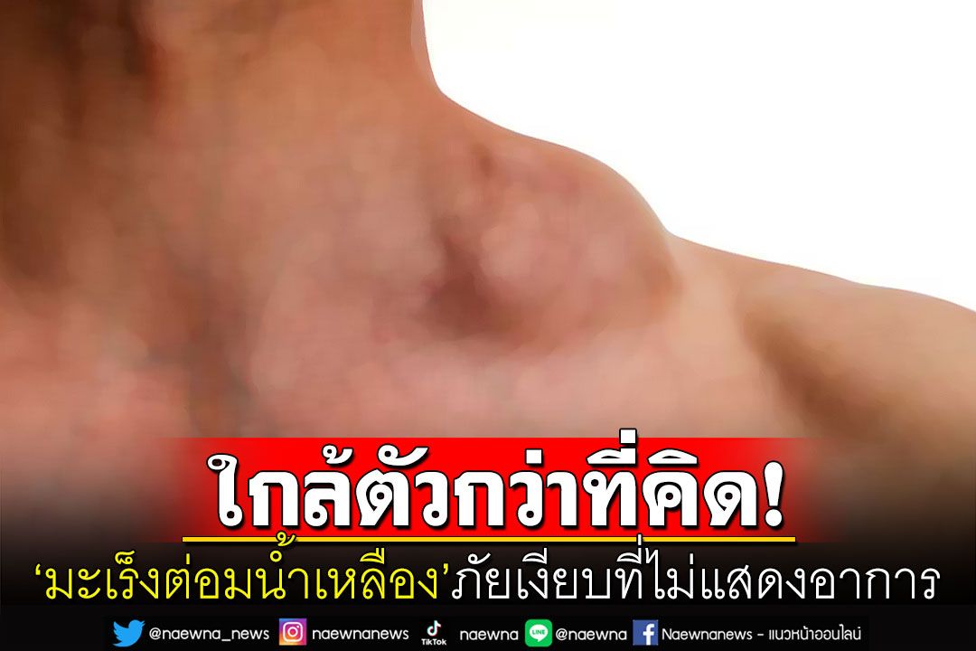 'มะเร็งต่อมน้ำเหลือง'พบบ่อยในคนไทย ชี้หากคลำเจอก้อนโตให้รีบไปพบแพทย์