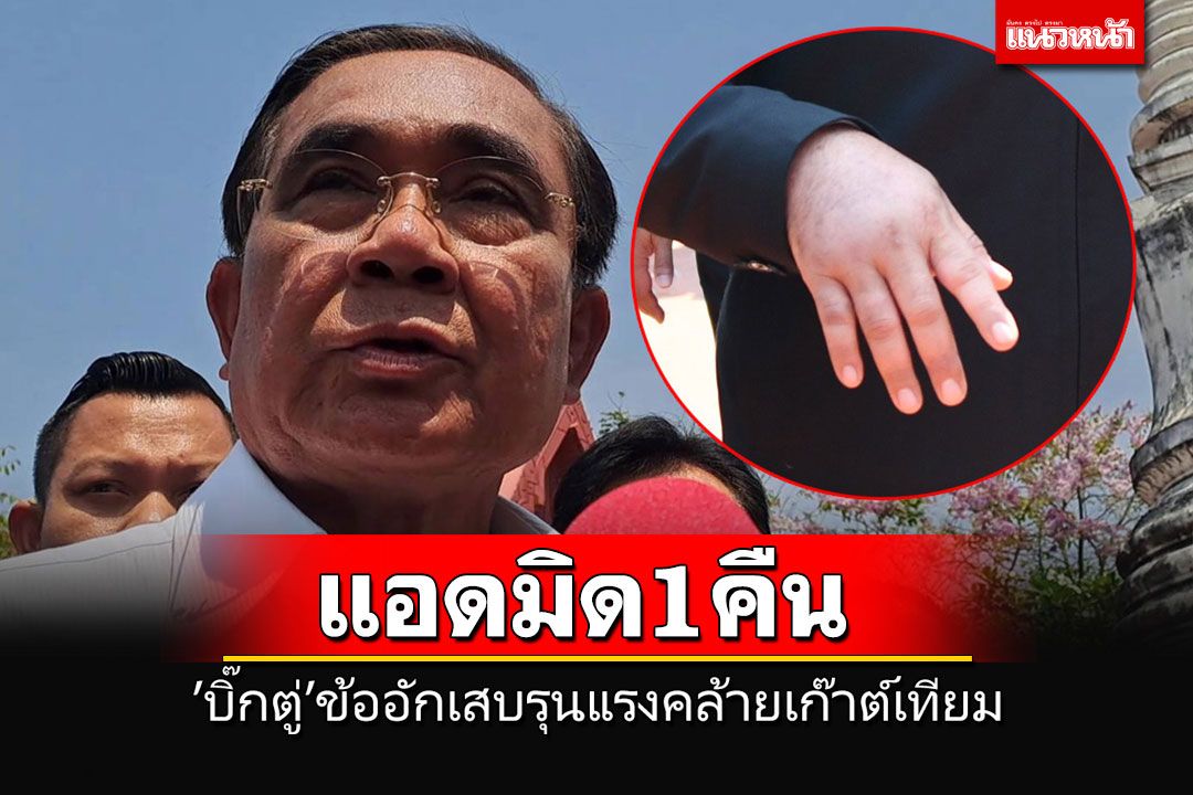 หมอสั่ง'บิ๊กตู่'แอดมิดรอดูอาการ 1 คืน  เผยอาการข้ออักเสบรุนแรงคล้ายโรคเก๊าต์เทียม