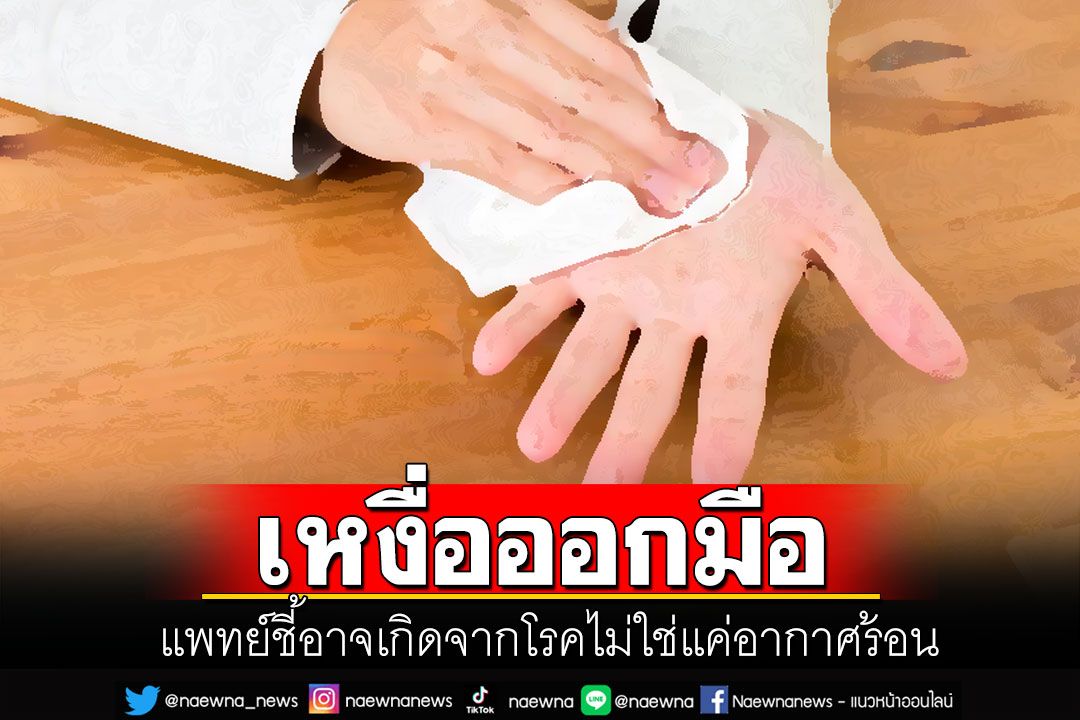 'เหงื่อออกมือ'ปัญหากวนใจใครหลายคน แพทย์ชี้อาจเกิดจากโรคไม่ใช่แค่ร้อน