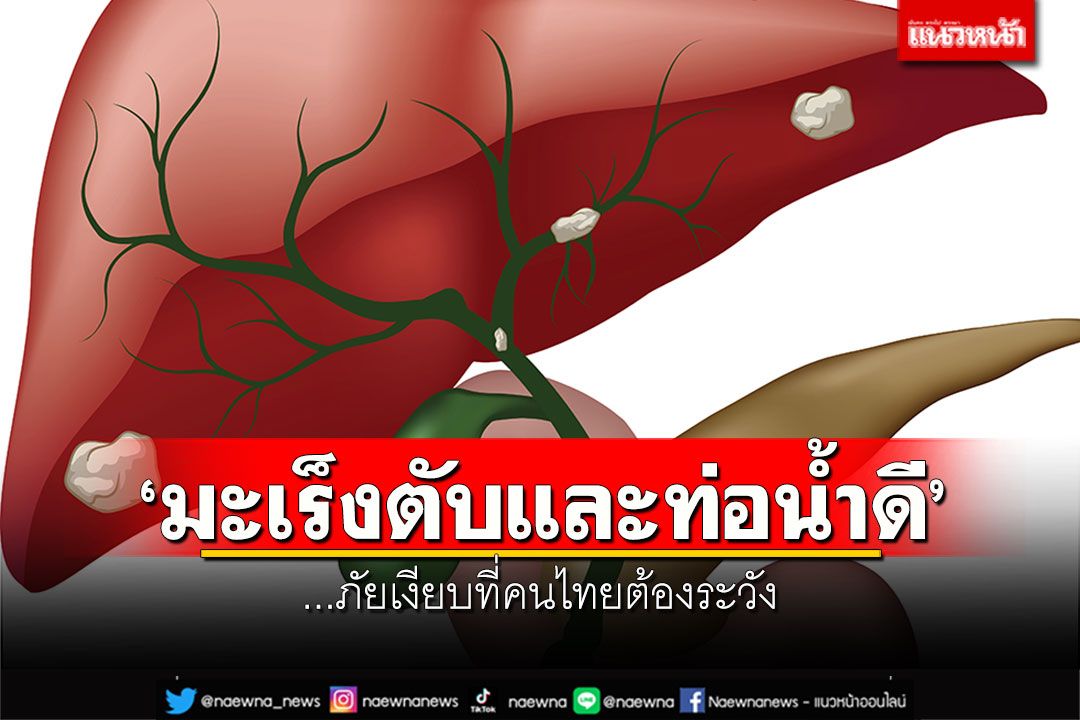 'มะเร็งตับและท่อน้ำดี'...ภัยเงียบที่คนไทยต้องระวัง