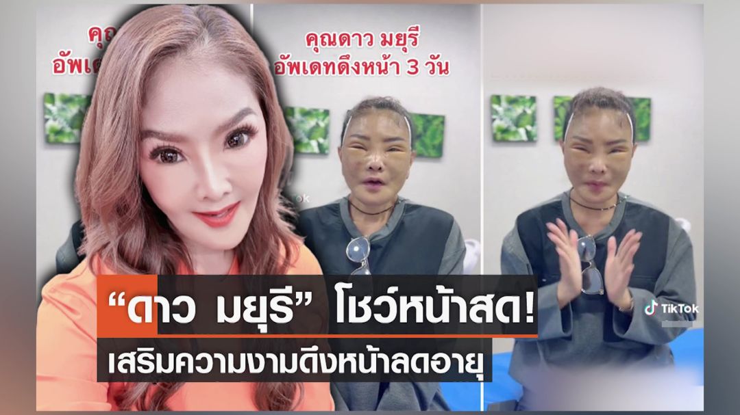 'ดาว มยุรี'ถูกบูลลี่หน้าผีจ่อฟ้องเกรียนคีย์บอร์ด  เผยตัดสินใจทำศัลยกรรมครั้งสุดท้ายในชีวิต
