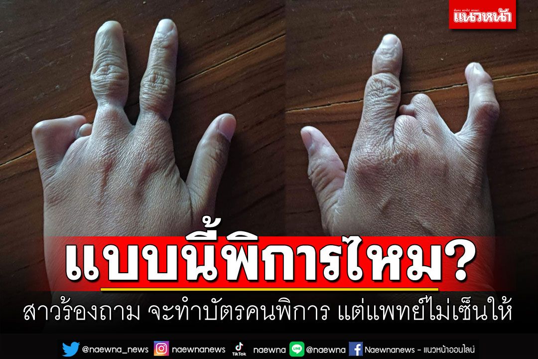 แบบนี้พิการหรือไม่? สาวร้องถาม จะไปขอทำบัตรผู้พิการ แต่แพทย์ไม่เซ็นให้