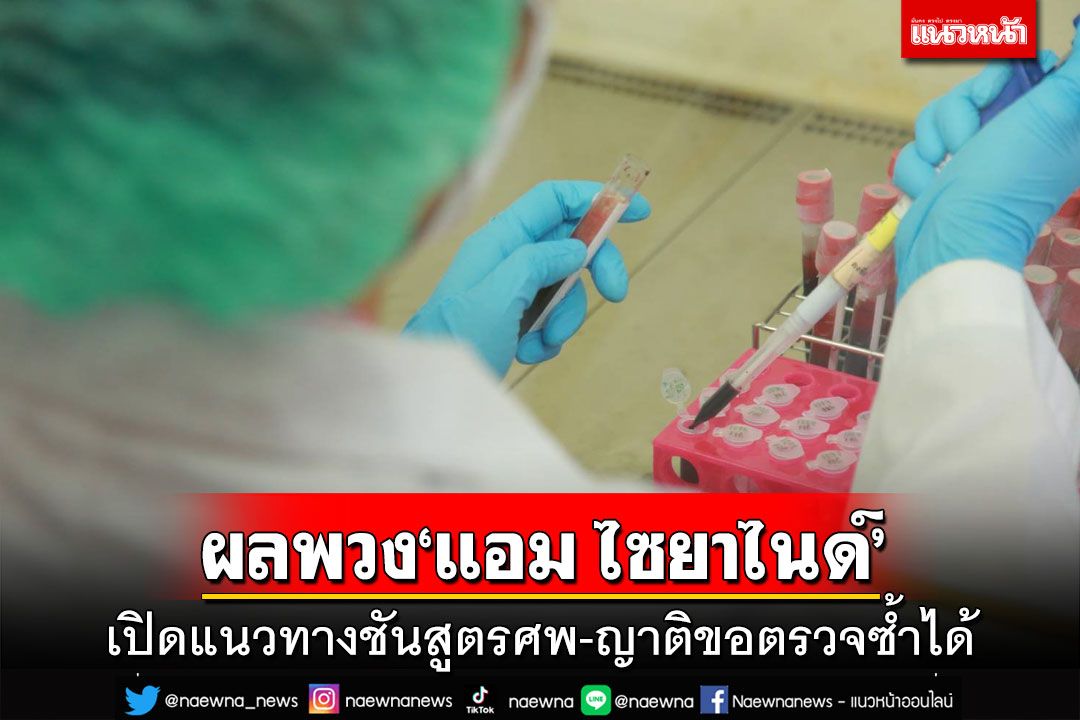 นิติวิทย์เปิดแนวทางชันสูตรศพตายผิดธรรมชาติ ญาติคาใจสาเหตุขอตรวจซ้ำได้