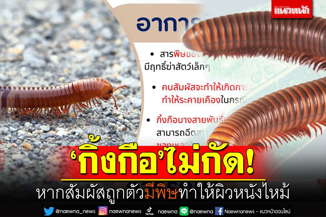 แพทย์ผิวหนังเตือน! 'กิ้งกือ'ในช่วงหน้าฝนไม่กัด แต่มีพิษทำให้ผิวหนังไหม้