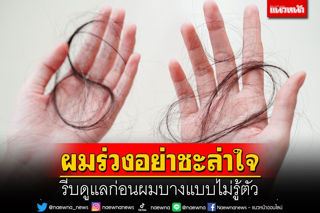 ผมร่วงอย่าชะล่าใจ รีบดูแลก่อนผมบางแบบไม่รู้ตัว