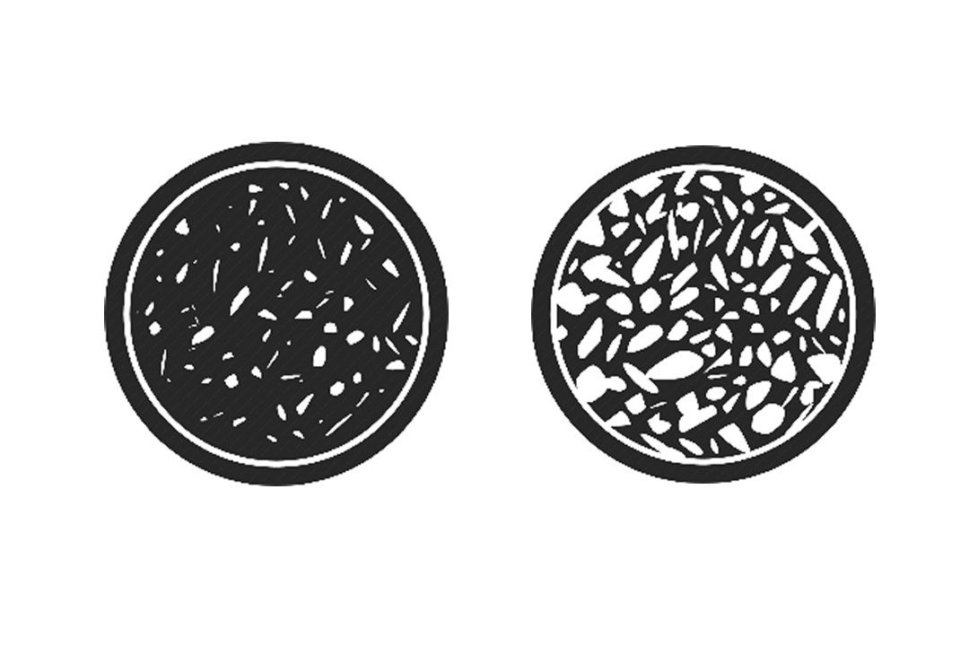 โรคกระดูกพรุน อันตรายกว่าที่คิด