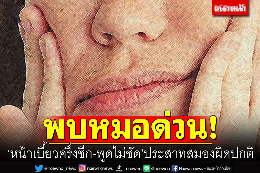พบหมอด่วน! เตือนอาการ'หน้าเบี้ยวครึ่งซีก-พูดไม่ชัด' ประสาทสมองผิดปกติ