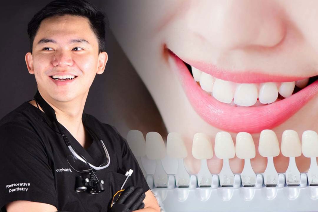 อันตรายจากการเลือกใช้ผลิตภัณฑ์ และวิธีฟอกสีฟันที่ไม่ได้มาตรฐาน