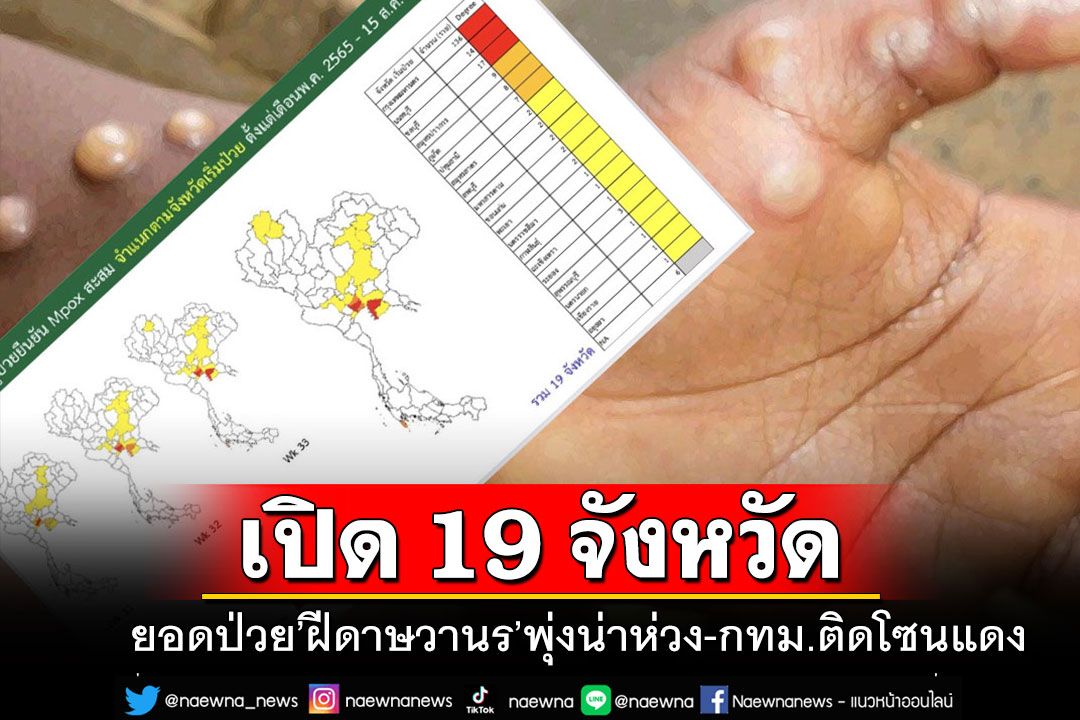 'ฝีดาษวานร'ในไทยน่าห่วง เปิด 19 จังหวัดป่วยมากสุด 'กทม.-นนท์-ชลบุรี'อยู่โซนแดง