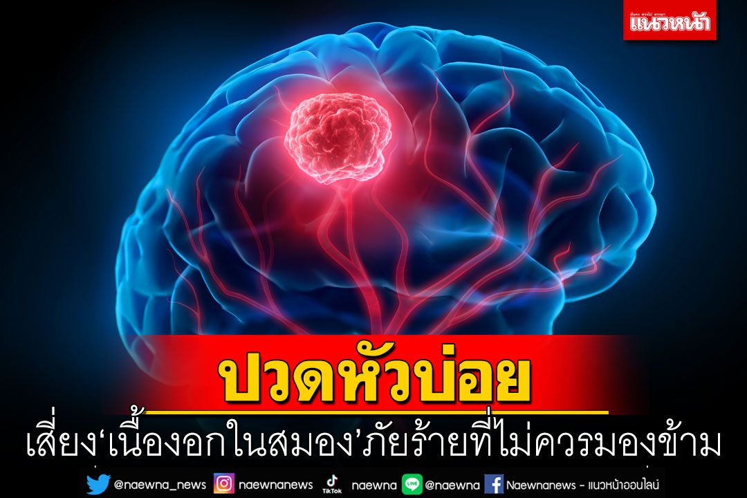 ปวดหัวบ่อย เสี่ยง ‘เนื้องอกในสมอง’ ภัยร้ายที่ไม่ควรมองข้าม