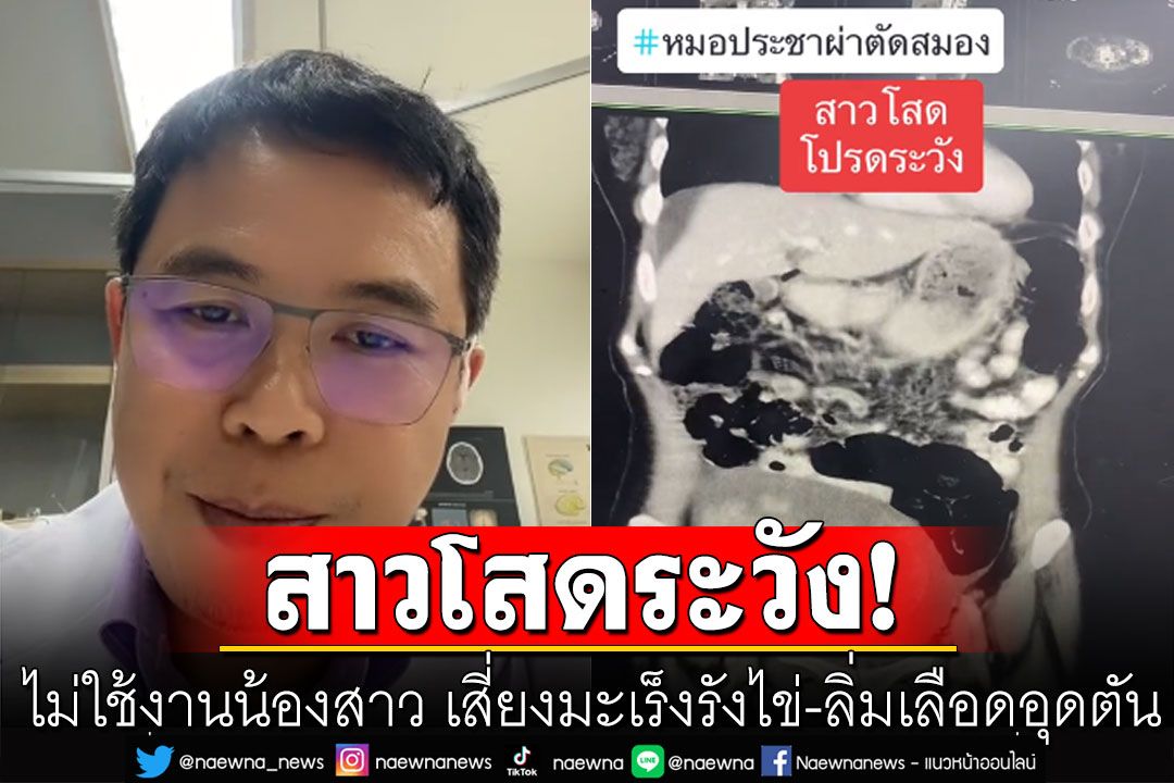 สาวโสดโปรดระวัง! หมอยกเคสหญิงที่ไม่ใช้งานน้องสาว มีโอกาสเสี่ยงมะเร็งรังไข่-ลิ่มเลือดอุดตัน