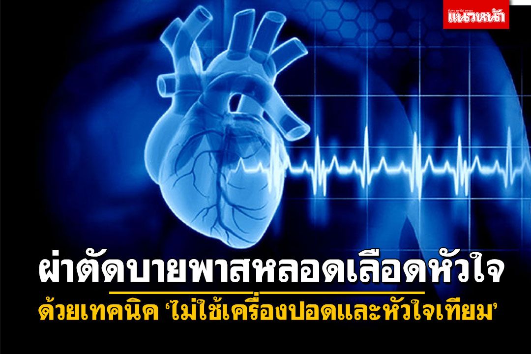 ผู้หญิง - ผ่าตัดบายพาสหลอดเลือดหัวใจ ด้วยเทคนิค ‘ไม่ใช้เครื่องปอดและ ...