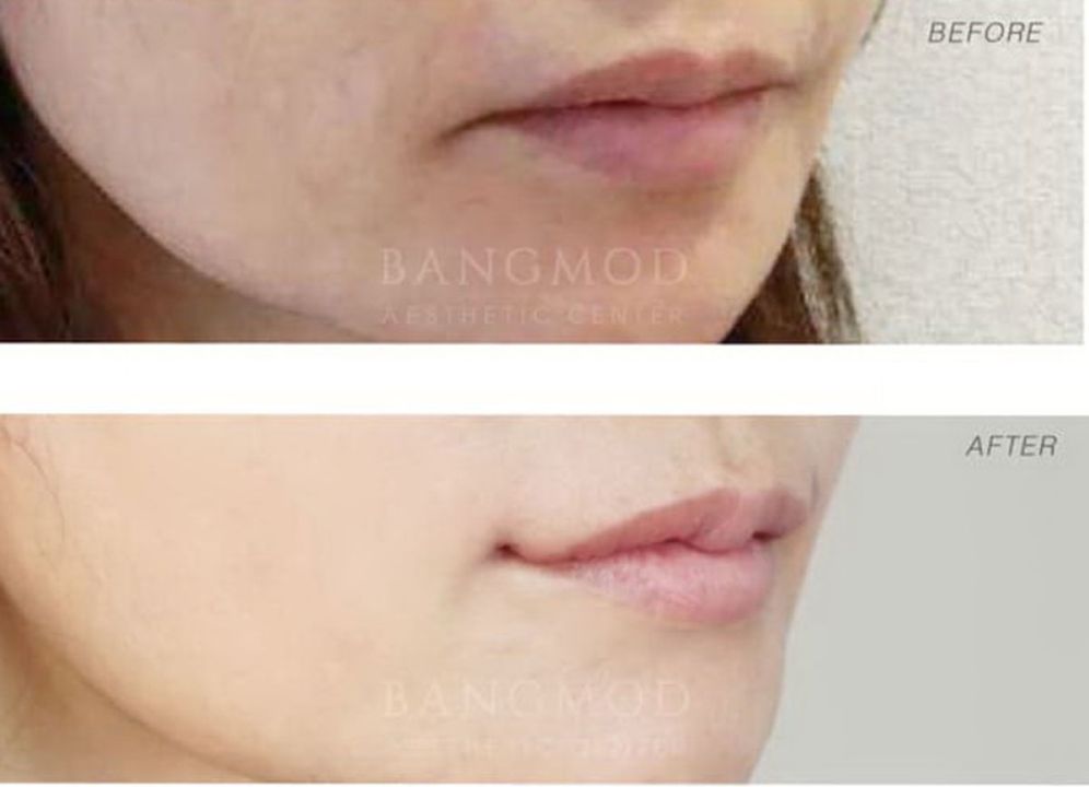 บอกลาคนทักว่าหน้าดุ ด้วยเทคนิคใหม่เฉพาะ‘ยกมุมปาก’