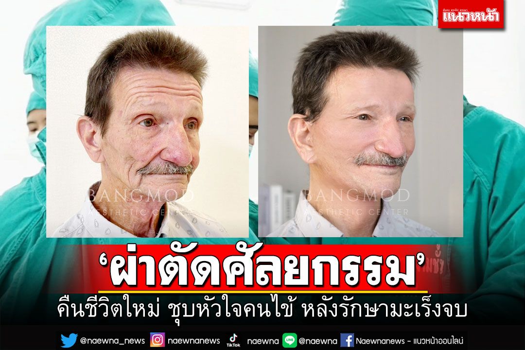 ‘ผ่าตัดศัลยกรรม’ คืนชีวิตใหม่ ชุบหัวใจคนไข้ หลังรักษามะเร็งจบ
