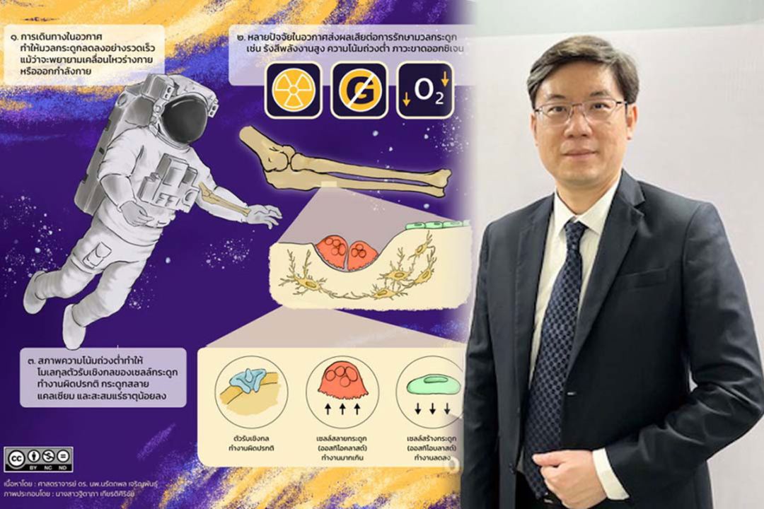 วิจัย‘ภาวะกระดูกพรุนในอวกาศ’ ต่อยอดความรู้สู่การดูแล‘ผู้ป่วยติดเตียง’