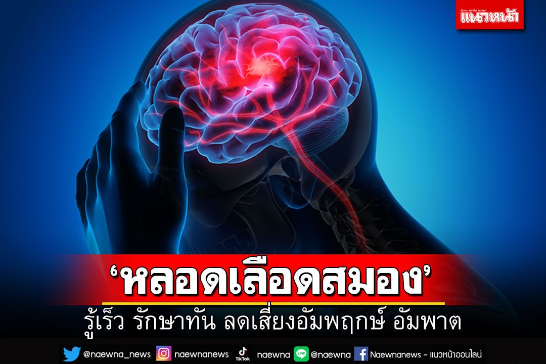 ‘หลอดเลือดสมอง’ รู้เร็ว รักษาทัน ลดเสี่ยงอัมพฤกษ์ อัมพาต