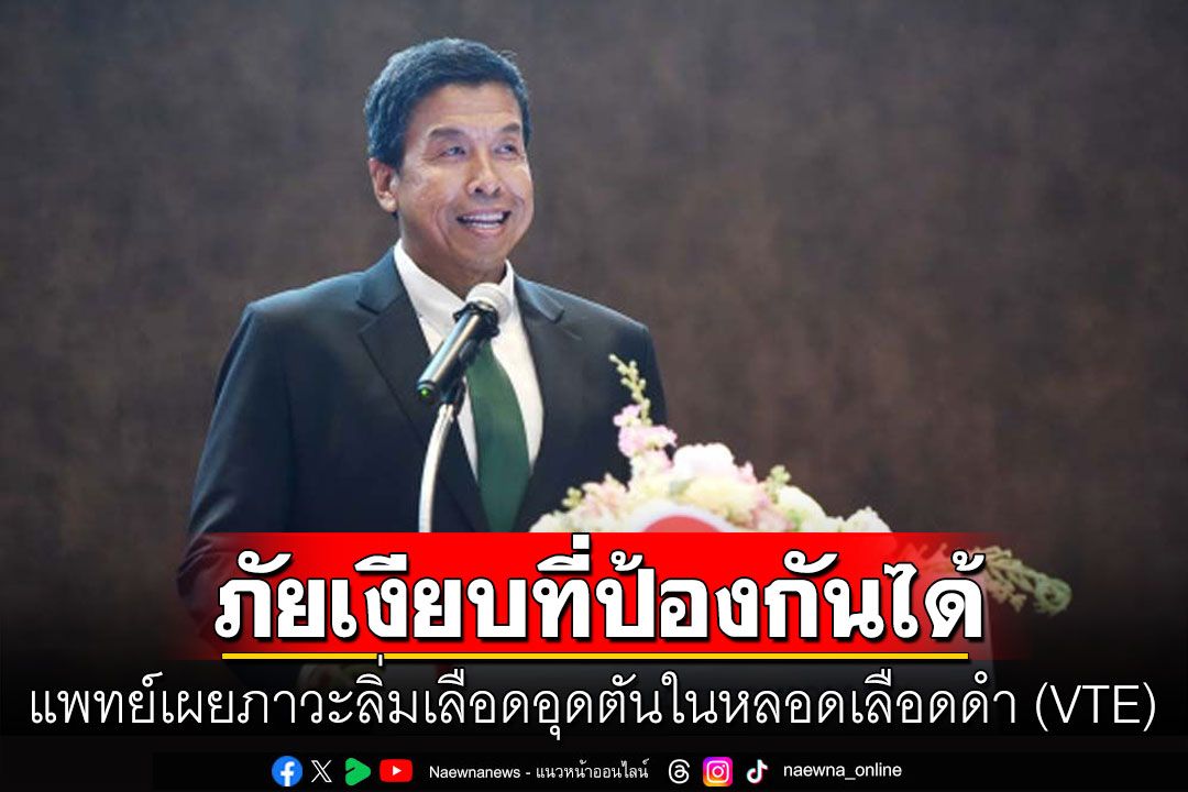 แพทย์เผยภาวะลิ่มเลือดอุดตันในหลอดเลือดดำ (VTE) ภัยเงียบที่ป้องกันได้