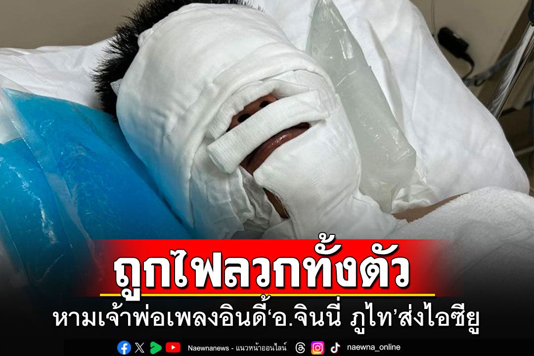 หามเจ้าพ่อเพลงอินดี้'อ.จินนี่ ภูไท' ส่งห้องไอซียู โดนไฟลวกเกือบทั้งตัว