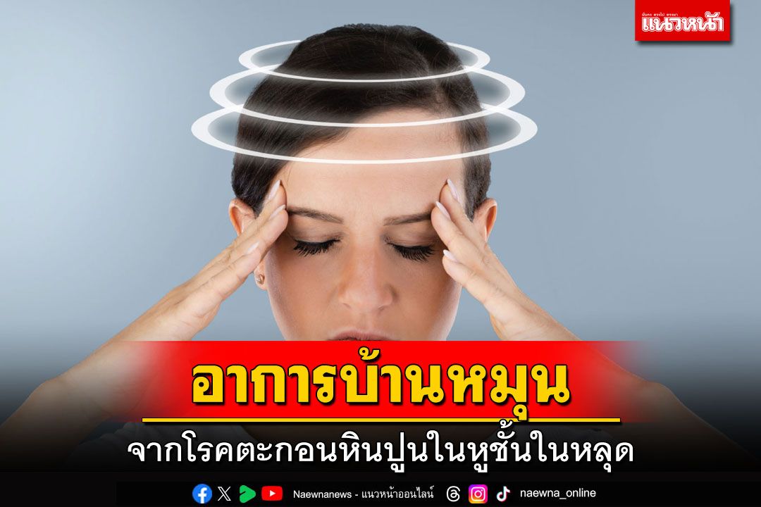 อาการบ้านหมุน จากโรคตะกอนหินปูนในหูชั้นในหลุด