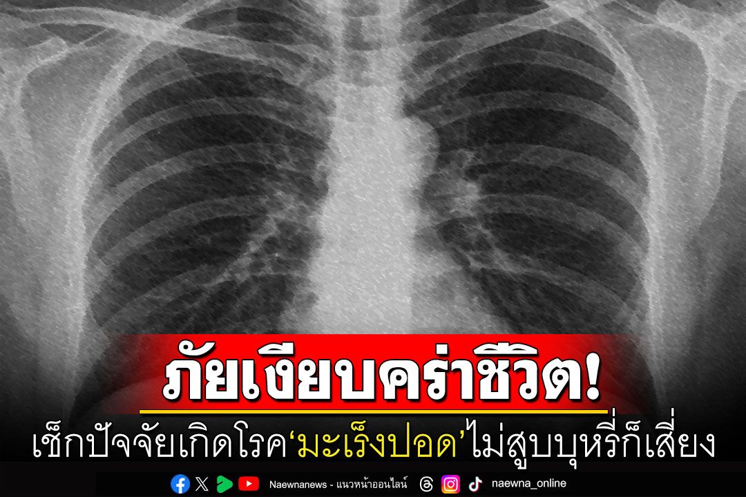 ภัยเงียบ! ไม่สูบบุหรี่ก็เสี่ยงเป็นโรค'มะเร็งปอด'ได้ แพทย์แนะเลี่ยงควันท่อไอเสีย-ควันธูป-ฝุ่นพิษ