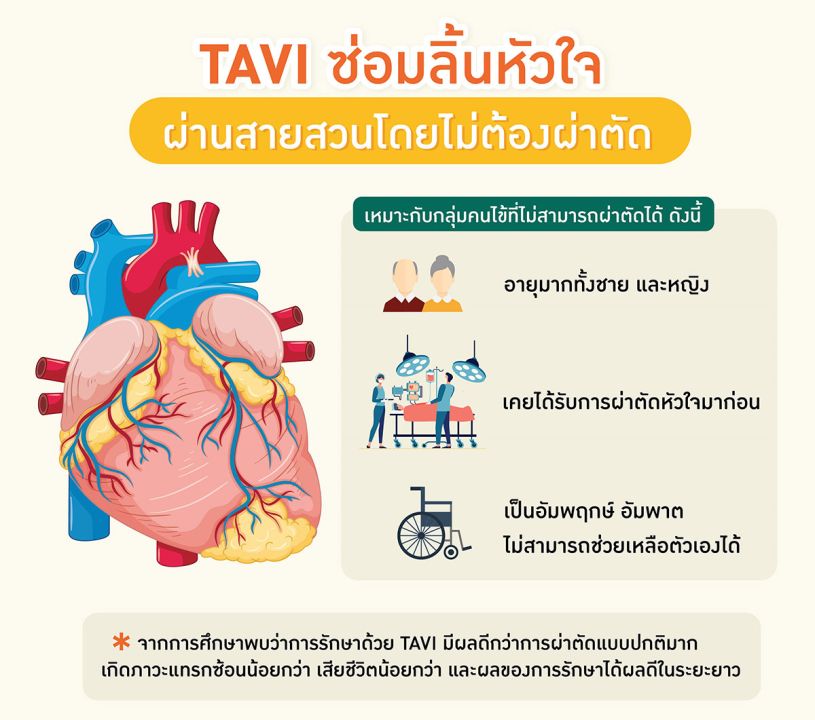 นวัตกรรมเพื่อผู้สูงอายุและผู้ป่วยโรคหัวใจ  TAVI ซ่อมลิ้นหัวใจผ่านสายสวนโดยไม่ต้องผ่าตัด