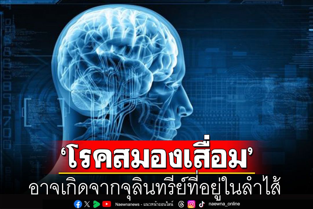 ‘ดร.อนันต์’ยกผลงานวิจัยไอร์แลนด์ 'โรคสมองเสื่อม'อาจเกิดจากจุลินทรีย์ที่อยู่ในลำไส้