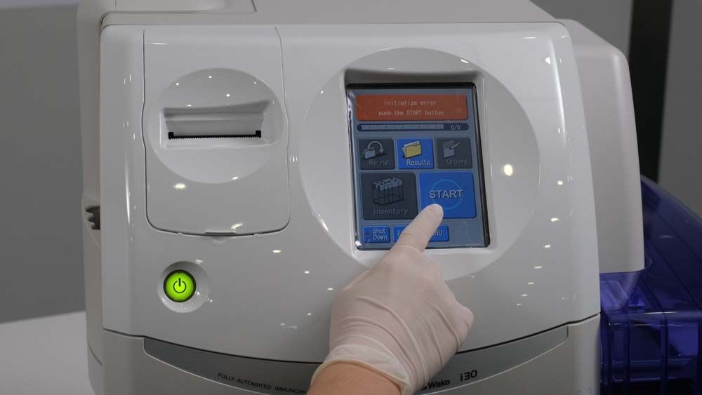 ฟูจิฟิล์ม เปิดตัวเทคโนโลยีตรวจคัดกรองขั้นสูง  ตรวจคัดกรองมะเร็งตับระยะแรก แม่นยำ รู้ผลเร็ว