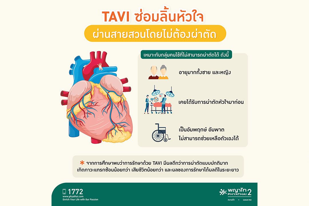 นวัตกรรมเพื่อผู้สูงอายุและผู้ป่วยโรคหัวใจ TAVI ซ่อมลิ้นหัวใจผ่านสายสวนโดยไม่ต้องผ่าตัด