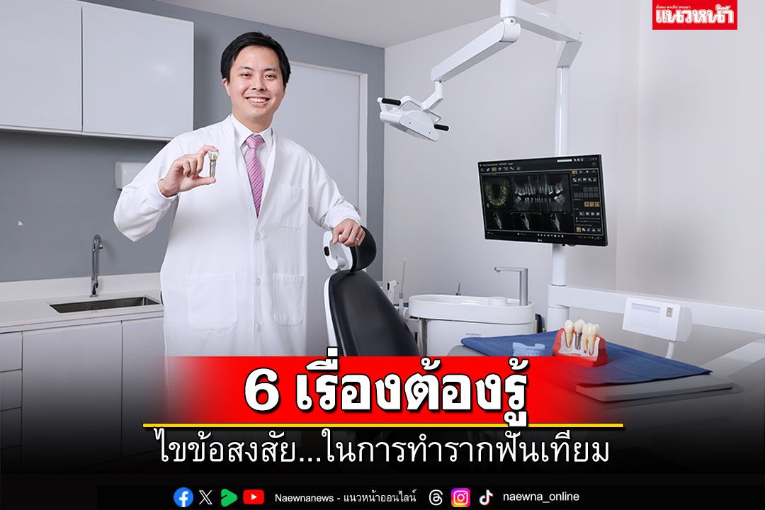 ไขข้อสงสัย 6 เรื่องต้องรู้ในการทำรากฟันเทียม