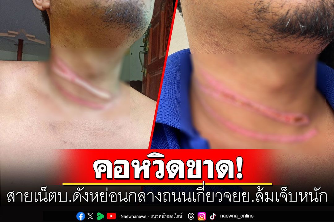 สายเน็ตหย่อนกลางถนน เกี่ยวคอผัว-เมียขี่จยย.ล้มคอหวิดขาด ไร้เงาคนรับผิดชอบ