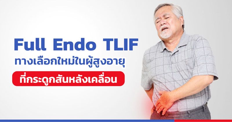 Full Endo TLIF ทางเลือกใหม่ผ่าตัดกระดูกสันหลังเคลื่อนในผู้สูงอายุ