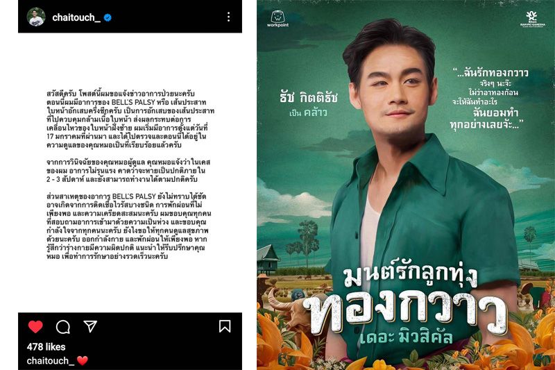 'ธัช - กิตติธัช' ป่วยโรคหน้าเบี้ยวครึ่งซีก เหตุโหมทำงานหนักจนพักผ่อนไม่พอ