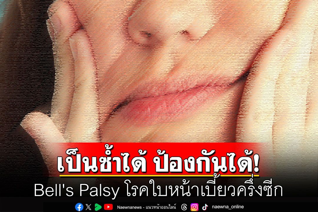 Bell's Palsy โรคใบหน้าเบี้ยวครึ่งซีก หายได้ เป็นซ้ำได้ ป้องกันได้!