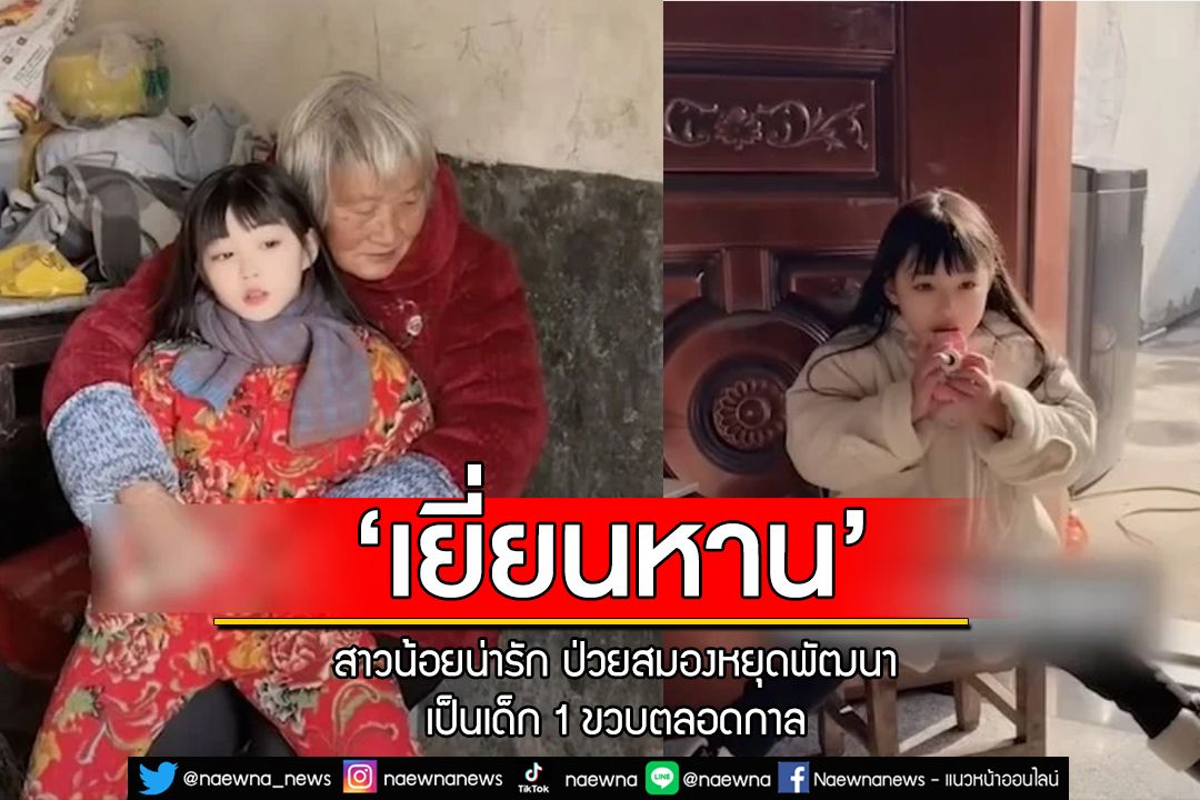 ‘เยี่ยนหาน’สาวน้อยน่ารัก ป่วยสมองหยุดพัฒนา เป็นเด็ก 1 ขวบตลอดกาล