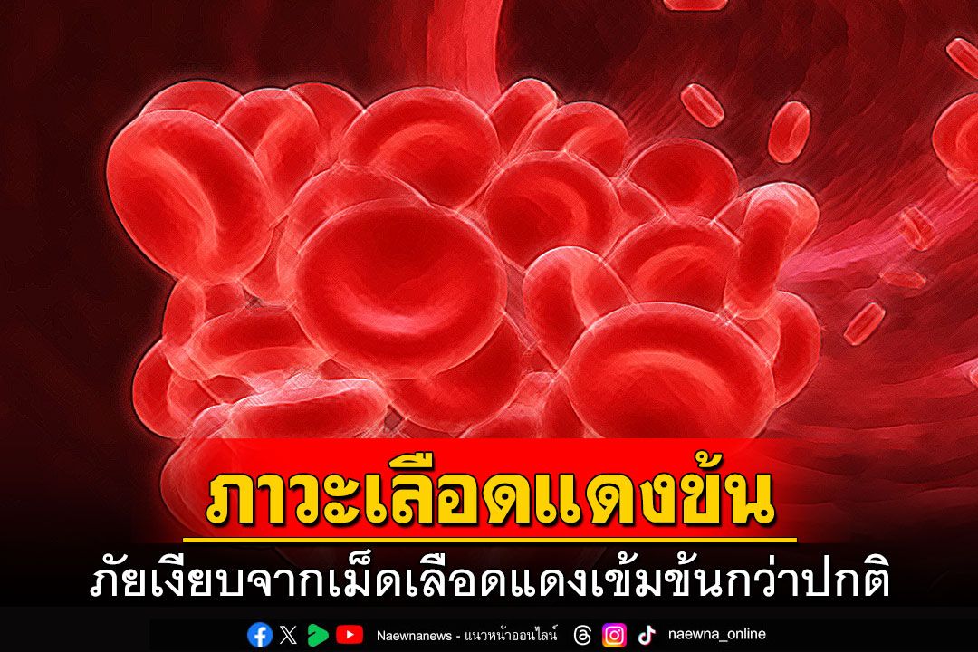 ภาวะเลือดแดงข้น…ภัยเงียบจากเม็ดเลือดแดงเข้มข้นกว่าปกติ