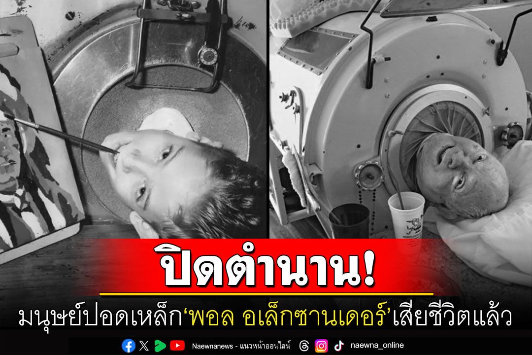 โลกอาลัย! มนุษย์ปอดเหล็ก'พอล อเล็กซานเดอร์'เสียชีวิตแล้ว หลังใช้ชีวิตอยู่ในถังนานกว่า 70 ปี