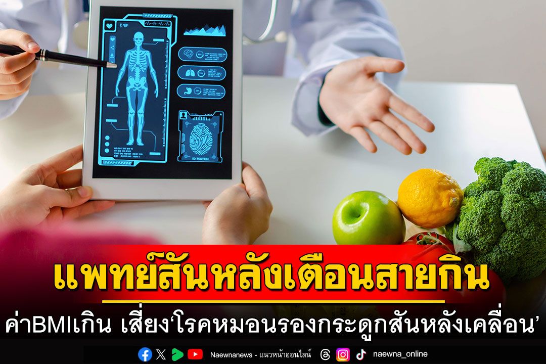 แพทย์สันหลังเตือนสายกิน ค่า BMI เกิน เสี่ยง ‘โรคหมอนรองกระดูกสันหลังเคลื่อน’