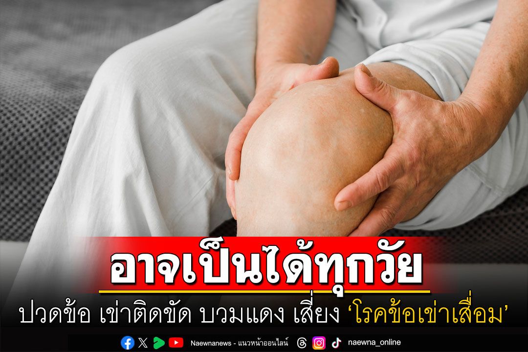 ปวดข้อ เข่าติดขัด บวมแดง เสี่ยง ‘โรคข้อเข่าเสื่อม’ ที่อาจเป็นได้ทุกวัย