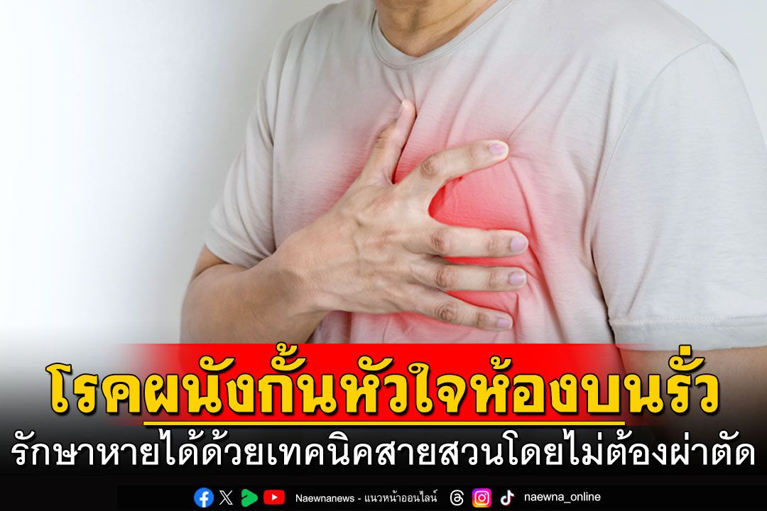 โรคผนังกั้นหัวใจห้องบนรั่ว รักษาหายได้ด้วยเทคนิคสายสวนโดยไม่ต้องผ่าตัด