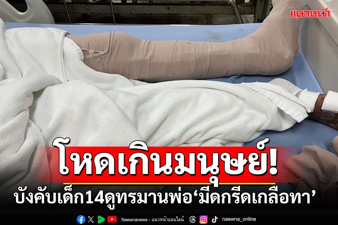 โหดเกินมนุษย์! คนร้ายบังคับลูกวัย14  ดูทรมานพ่อสาหัส มีดกรีดขาเกลือทา