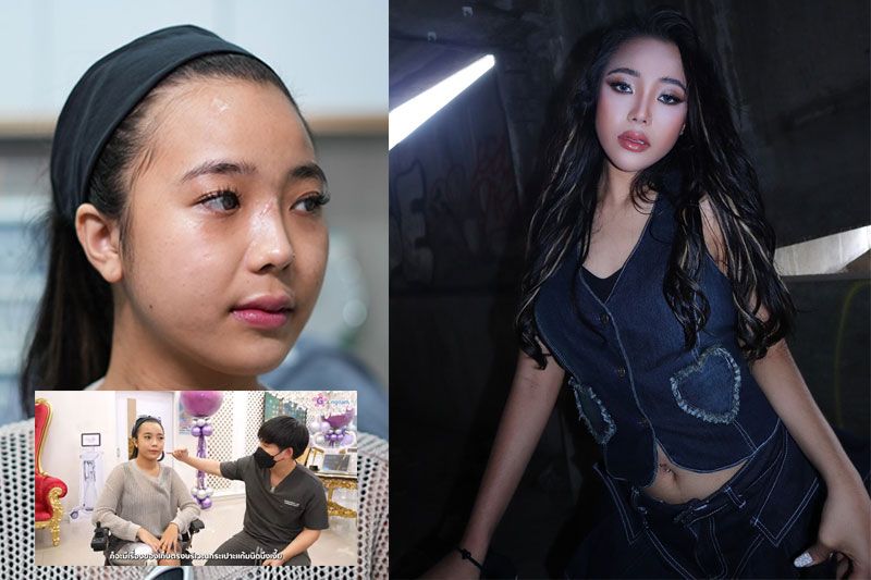 สายฝอสุด 'Make Over' น้องขนุน สาวที่ถูกแผ่นปูนทับ จนต้องใส่ขาเหล็ก แปลงโฉมจนแทบจำไม่ได้