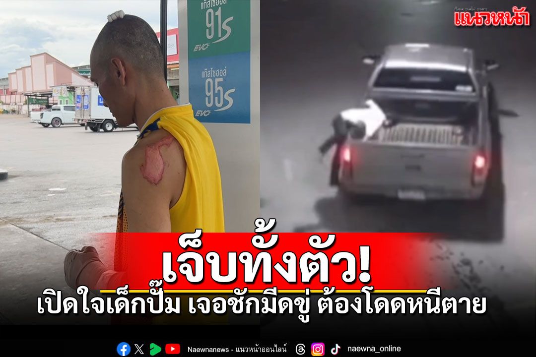เด็กปั๊มชาวเมียนมาเจ็บทั่วร่างกาย โดดหนีกระบะซิ่ง ชักมีดขู่ เชิดค่าน้ำมัน2.5พัน