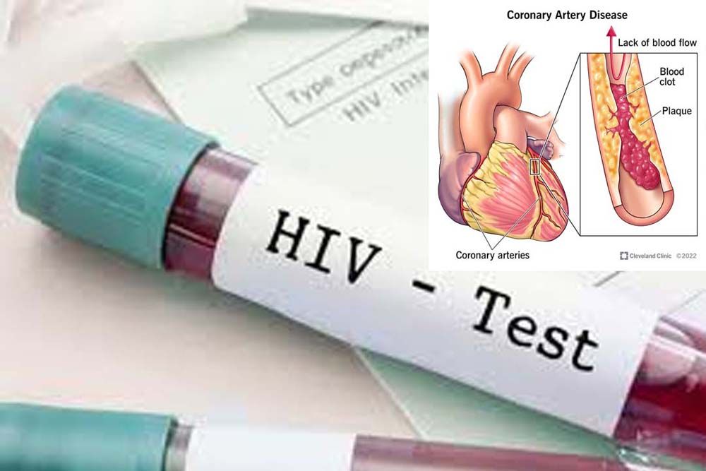 ‘ม.มหิดล-สธ.’ร่วมวิจัยระบาดวิทยา  ‘HIV-โรคหัวใจ’พร้อมขยายผล‘NCDs’